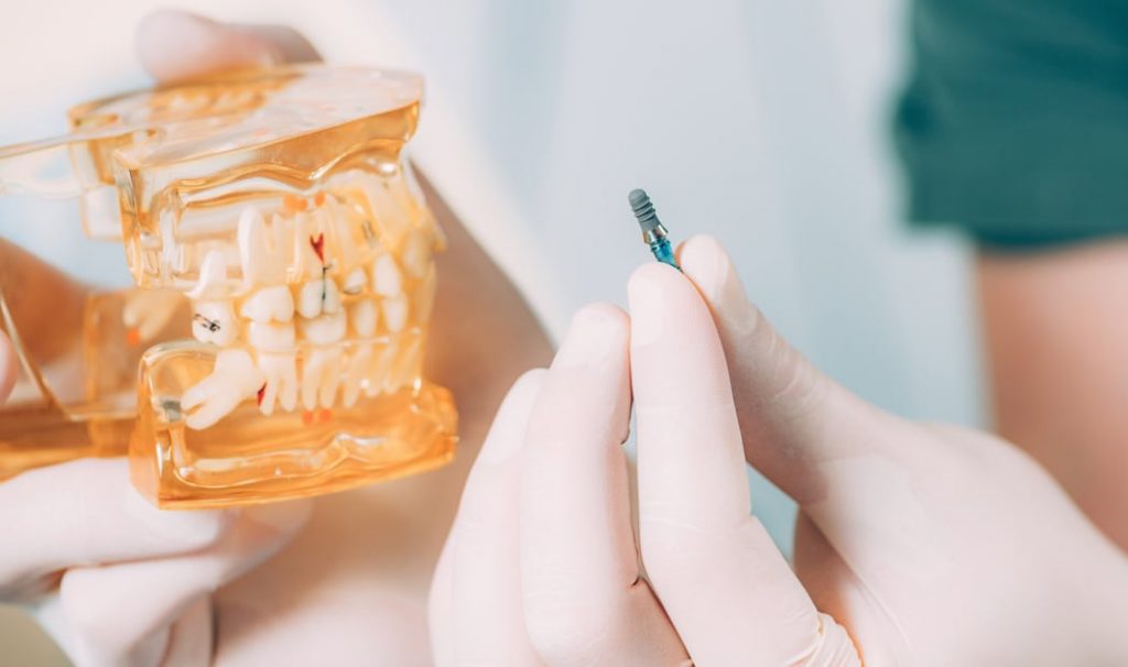 Dental Implants in hand